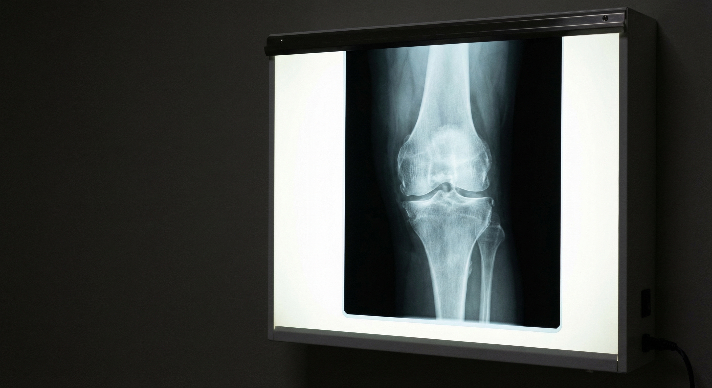 X-ray of knee joint